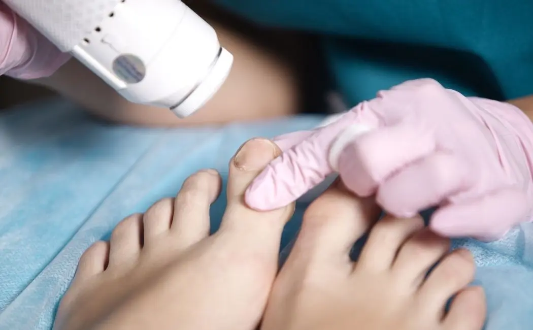 Grzybica paznokci jak leczyć?