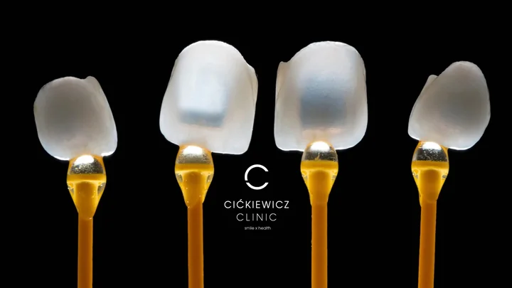 Obrazek przedstawia licówki porcelanowe oraz logo Cićkiewicz Clinic Warszawa