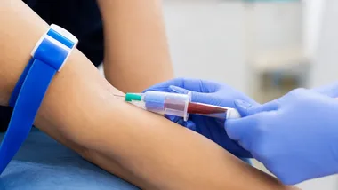 Trzy badania z jednego pobrania. Bezpłatna akcja w Wilanowie
