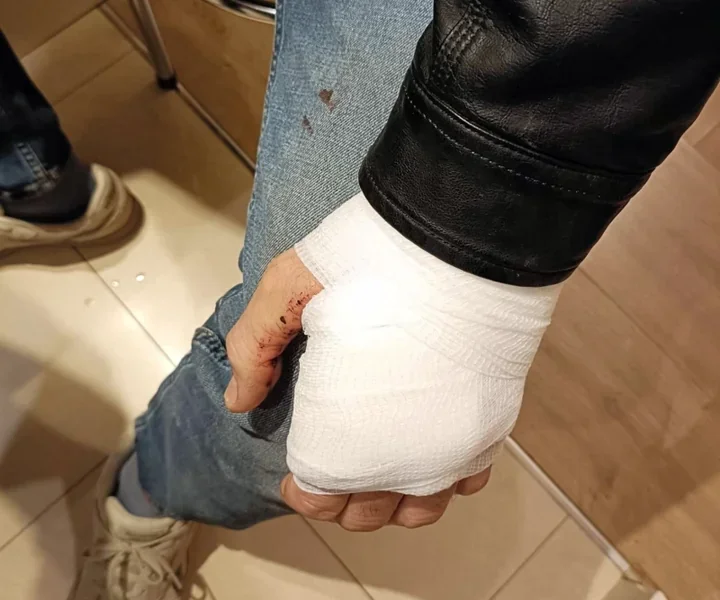 Śpiący mąż w lesie zaskoczył strażników na Białołęce